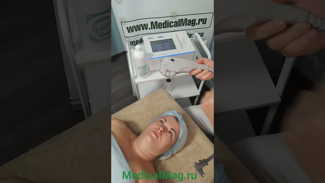 Портативный аппарат HIFU для SMAS лифтинга MBT-HIFU mini
