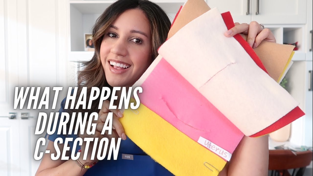 What Happens During a C-section?! | Explained by an OBGYN