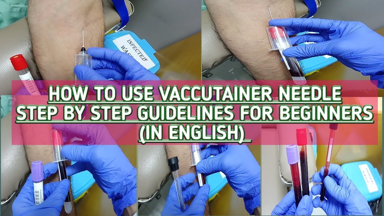 Blood collection by veinpuncture method by using vacutainer. step by step guidelines.