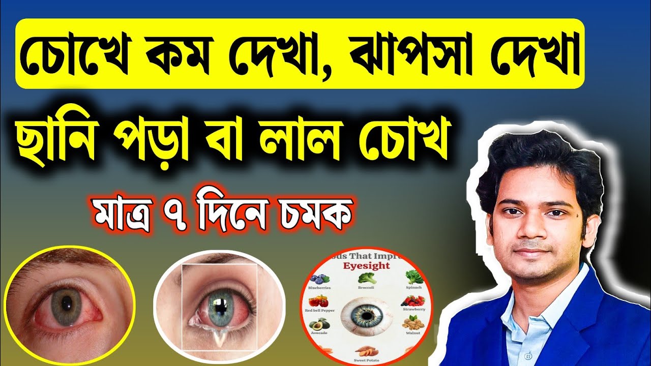 এই ফলটি নিয়মিত খেলে বয়স ৬০ এর পরেও চোখ হবে বাজপাখির মতো! দ্রুত দৃষ্টিশক্তি বাড়ানোর ঘরোয়া উপায় |