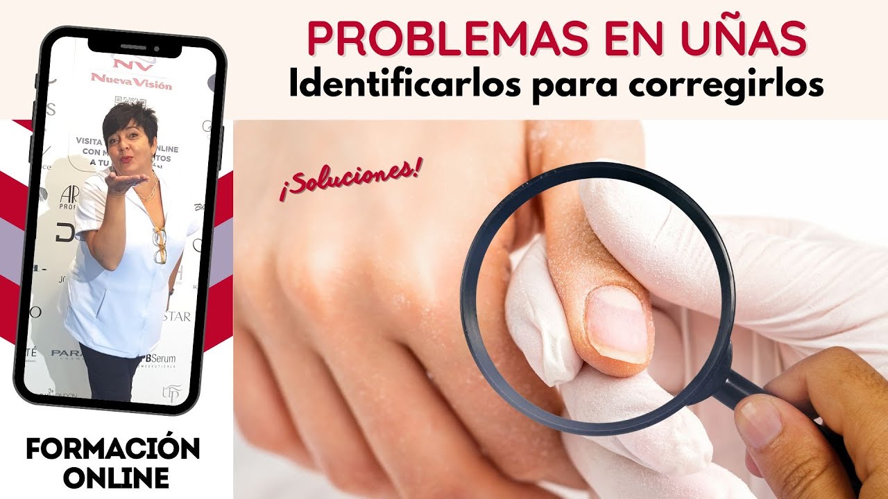 ¿Cuáles son los problemas más comunes de las uñas?
