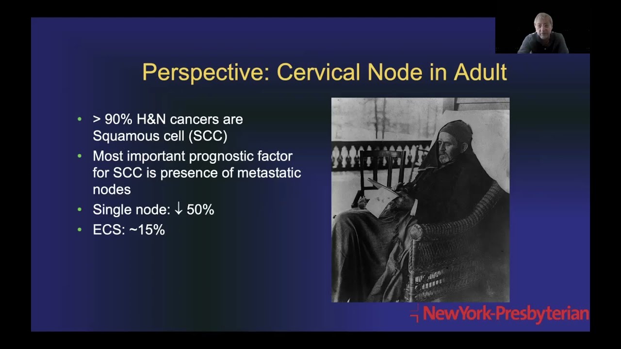 Cervical Lymph Nodes and H&N Lymphoma by C. Douglas Phillips, M.D., FACR