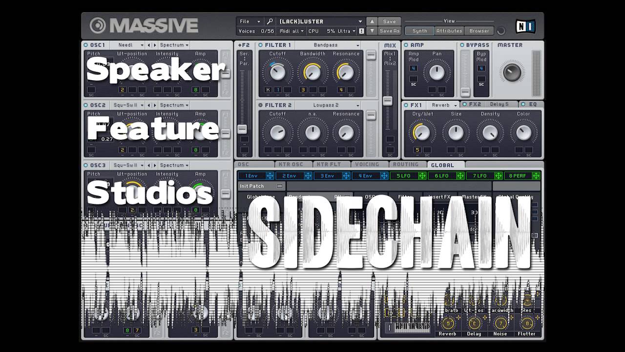 Massive Preset Soundbank - Sidechain by Speaker Feature Studios