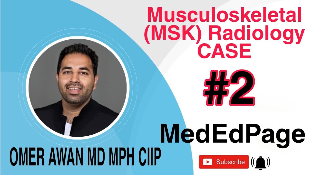 Musculoskeletal (MSK) Radiology CASE #2