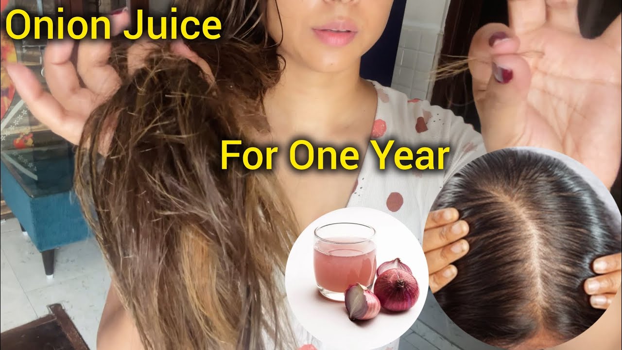 I HAVE BEEN USING ONION JUICE FOR ONE YEAR STRAIGHT !  And this happen ....😓😥