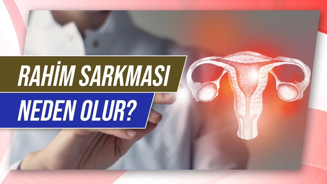 Rahim Sarkması Nedir? Rahim Sarkması Belirtileri Nelerdir? Rahim Sarkması Evreleri Nelerdir?