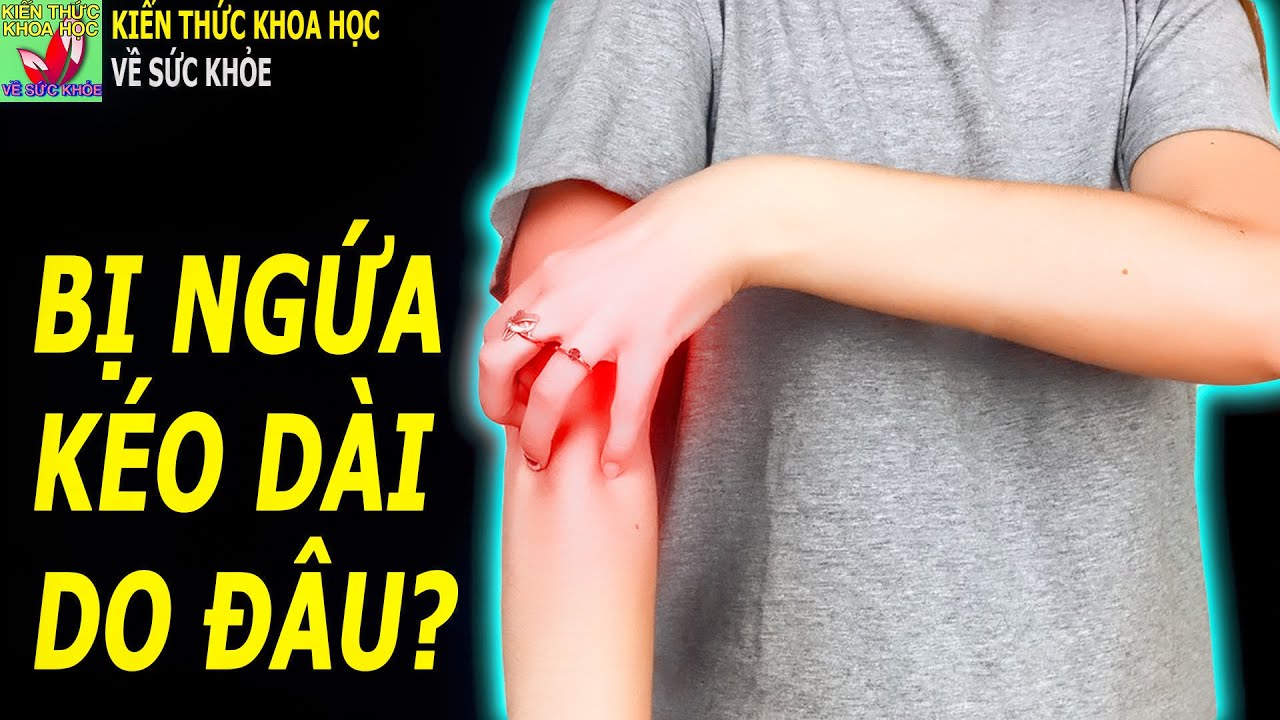 Ngứa ng&aacute;y k&eacute;o d&agrave;i cẩn thận bệnh trọng