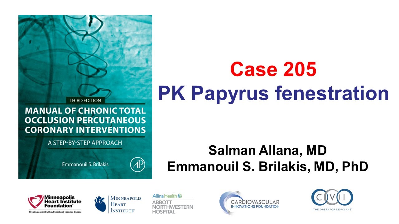 Case 205: Manual of CTO PCI - PK Papyrus fenestration