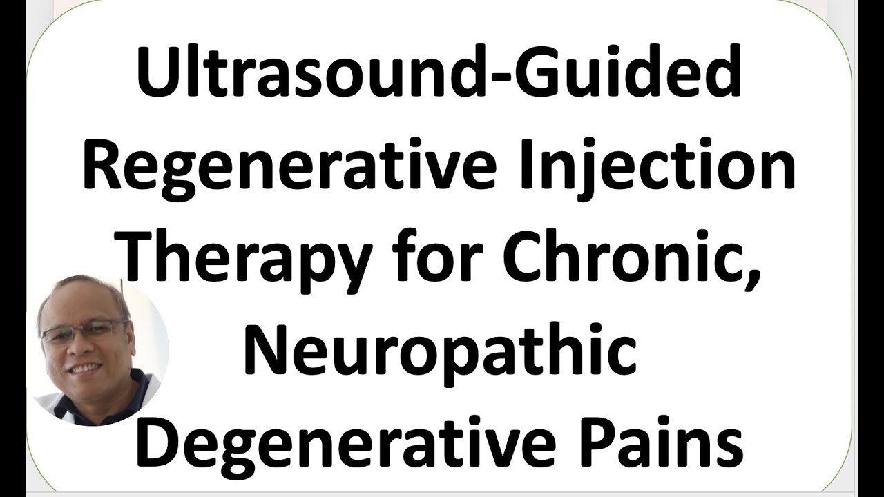 Ultrasound-Guided Regenerative Injection Therapy: Chronic, Neuropathic Pains Degenerative Conditions