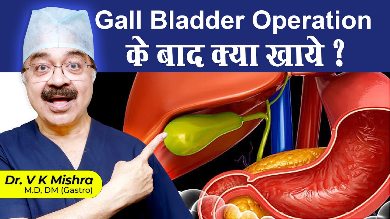 Gall Bladder Operation के बाद क्या खाये ? || HOW TO CHANGE YOUR DIET AFTER GALL BLADDER REMOVAL
