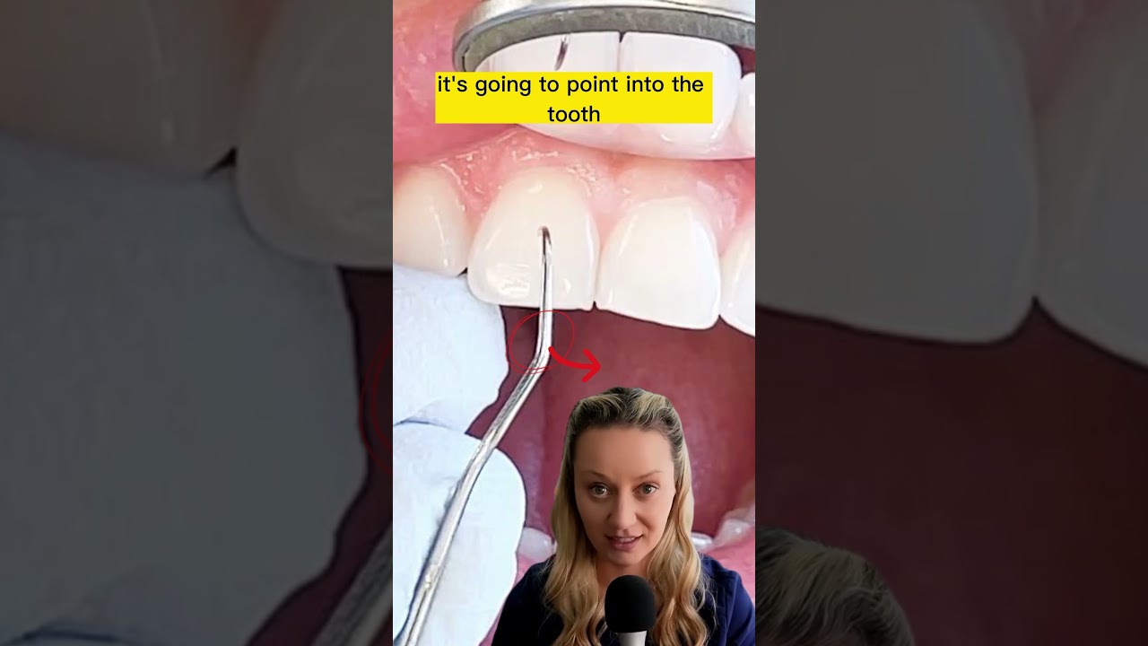 Как пользоваться зондом 11/12: подробное объяснение. | Toothlife Irene