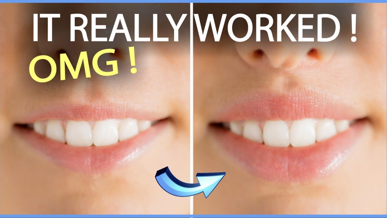 No Injections! Just 4 minutes a Day — and Yes, Your Lips Will Look Plumper!