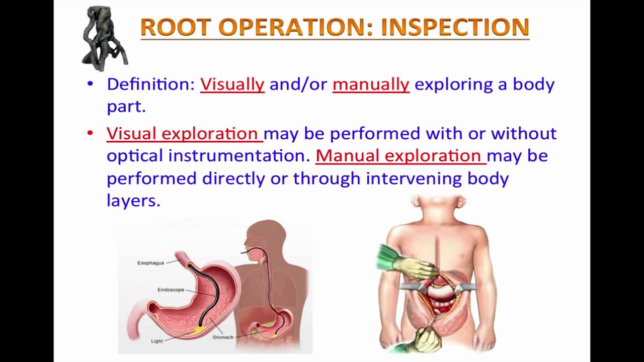 Lesson 5 - Root Operation: Inspection