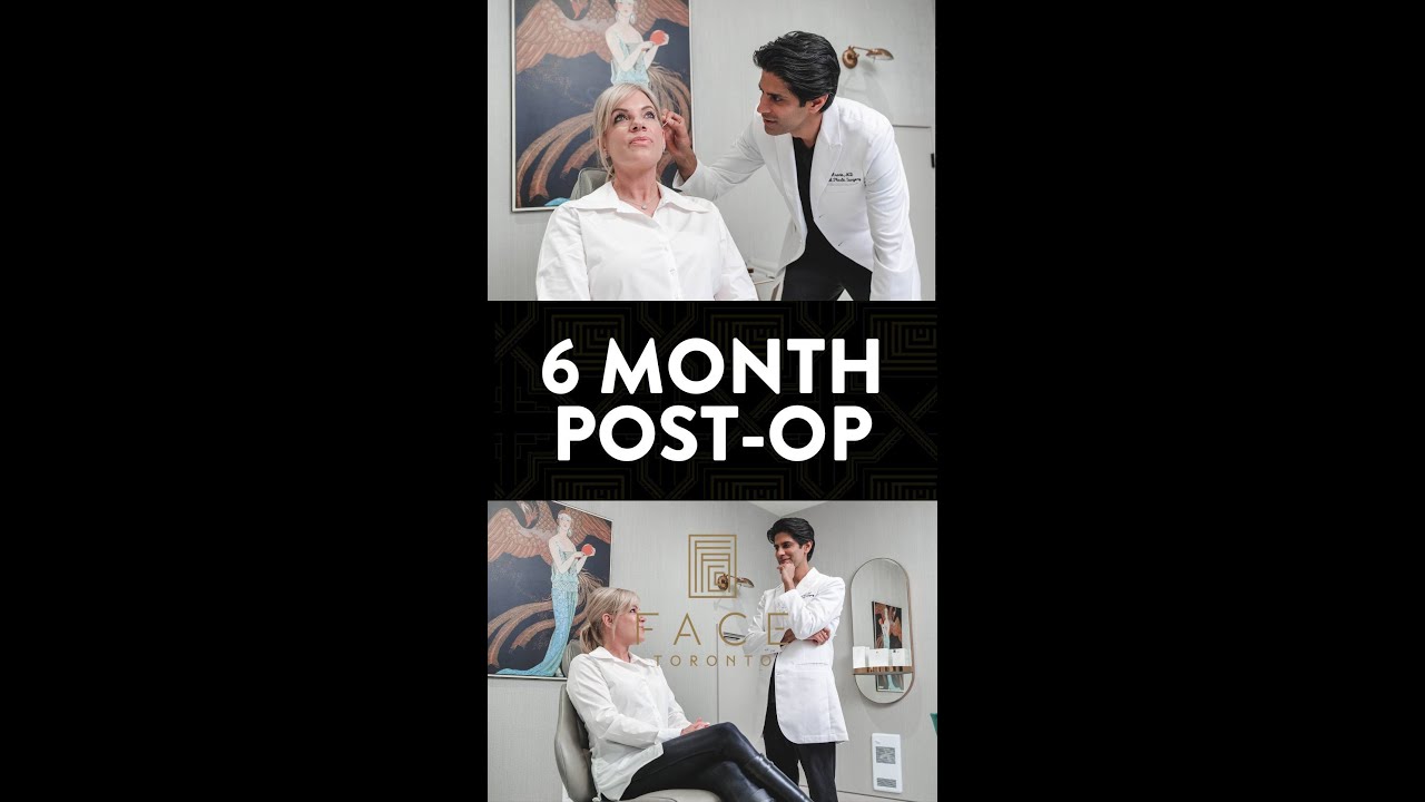 Dr. Jamil Asaria - 6 Month Post Op Check-In