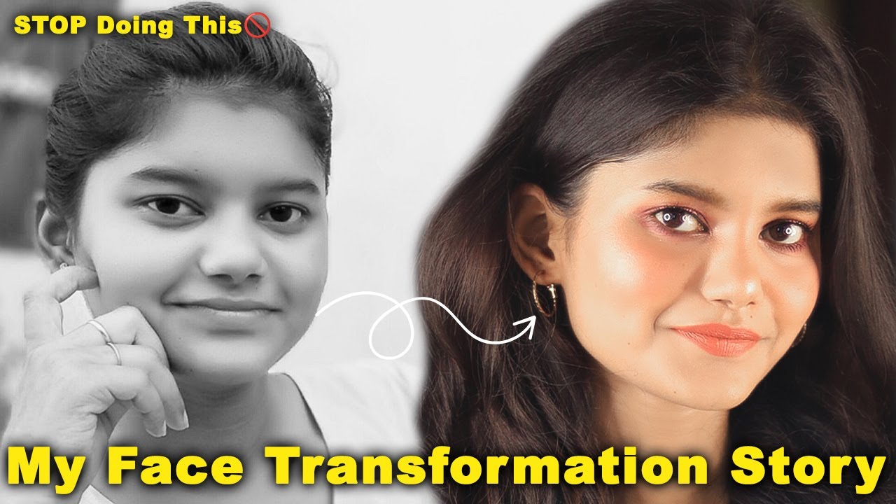 &ldquo;Transformation Series&rdquo; My Personal Honest Glow Up Story | Upgrade Your Face Card | #transformation
