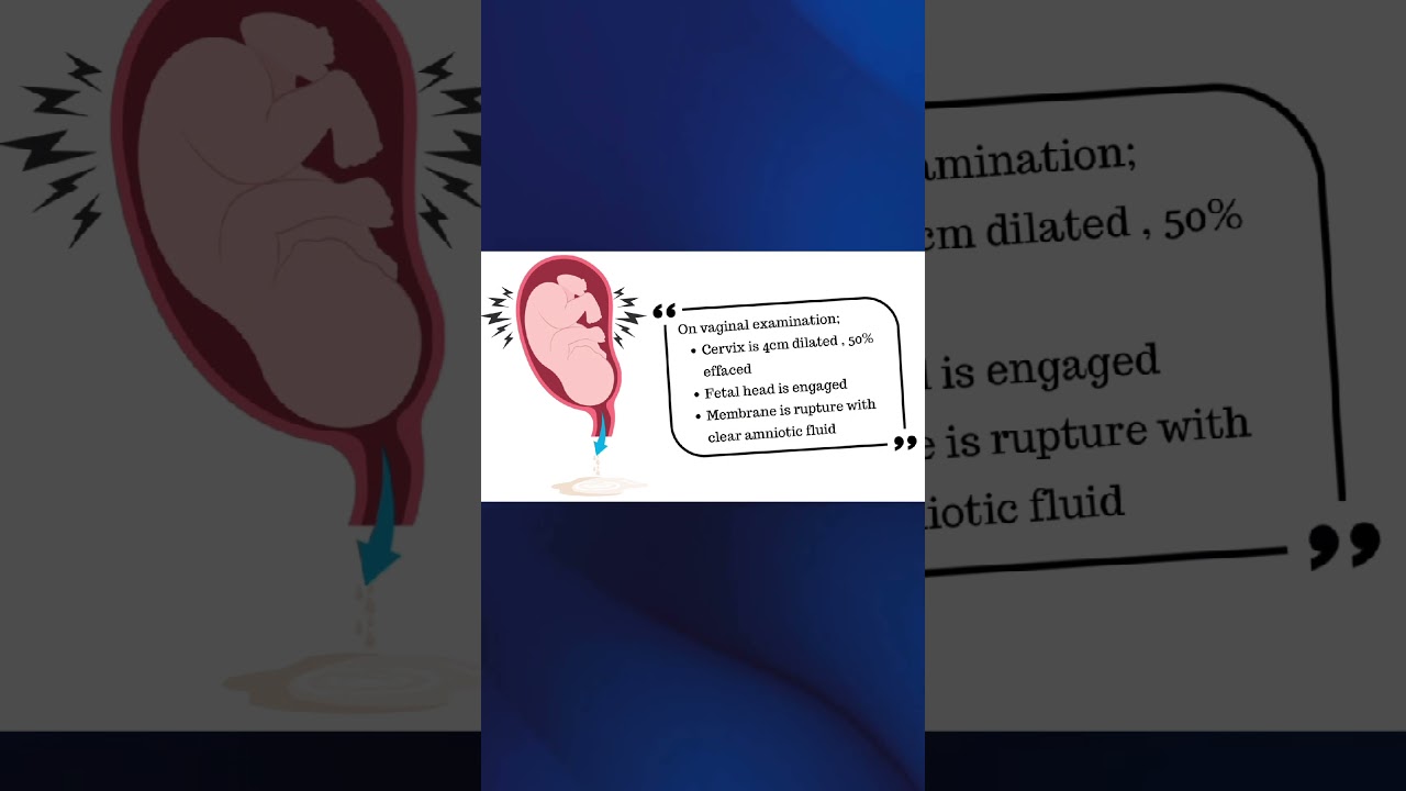 How would you help Sarah through this stage of labor? 