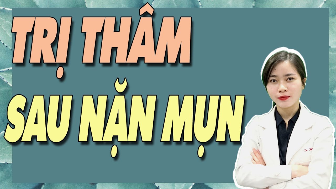 Bật mí 5 cách TRỊ THÂM sau NẶN MỤN hiệu quả | Bs Nguyễn Ngọc