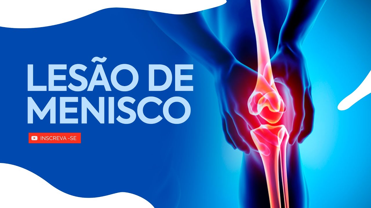 Tudo Sobre Lesão de Menisco: Sintomas, Tratamento e Recuperação