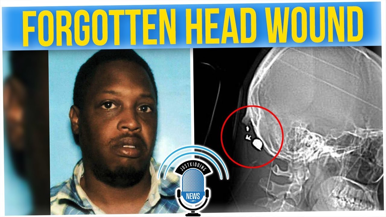 Woman Found Out What Really Happened with Her Head Injury (ft. Hok)