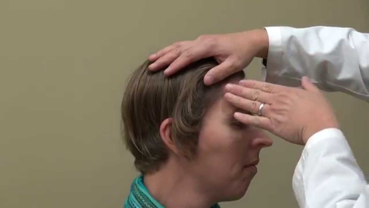 Hair Transplant Result Transgender Woman Feminine Hairline Bald Hair Loss Diep www.mhtaclinic.com