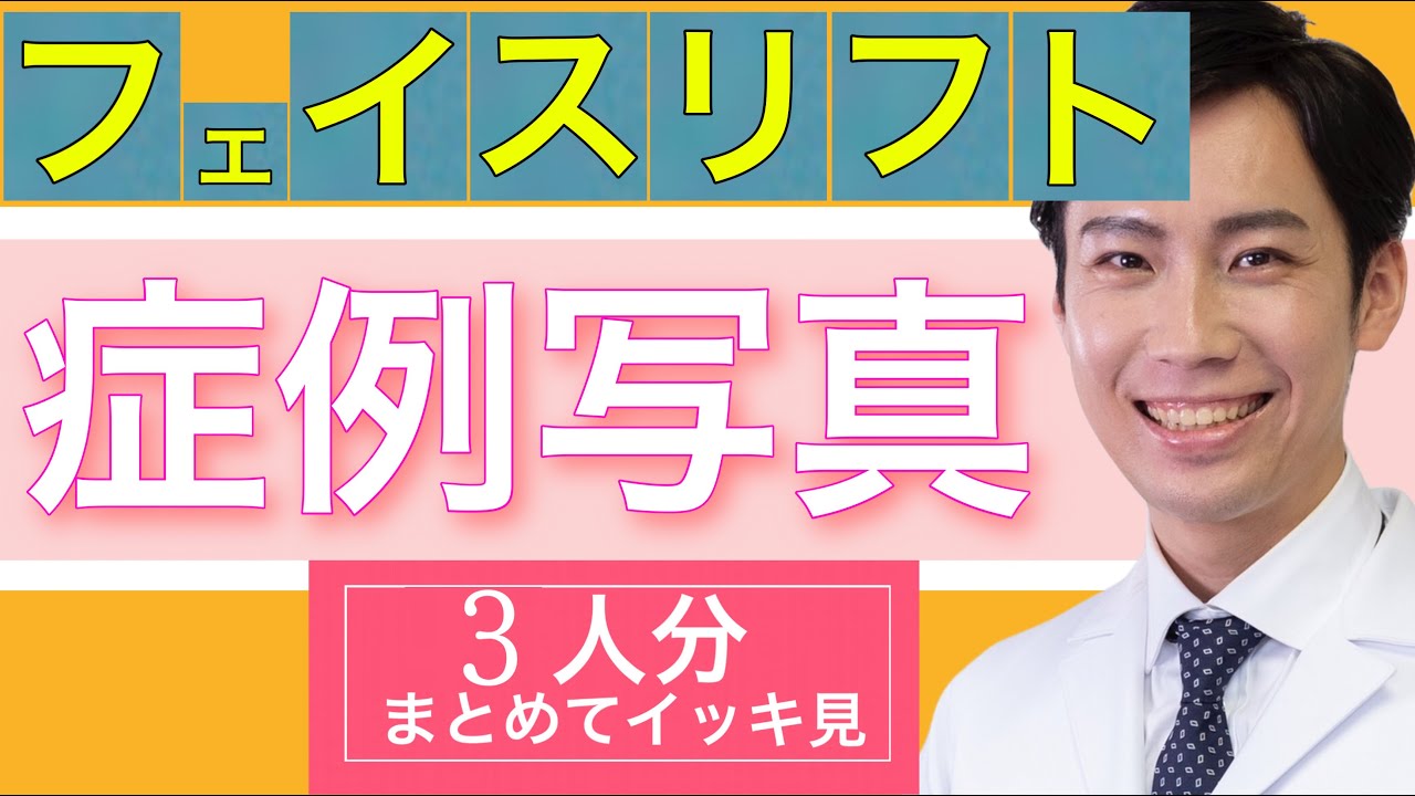フェイスリフトの症例写真一覧