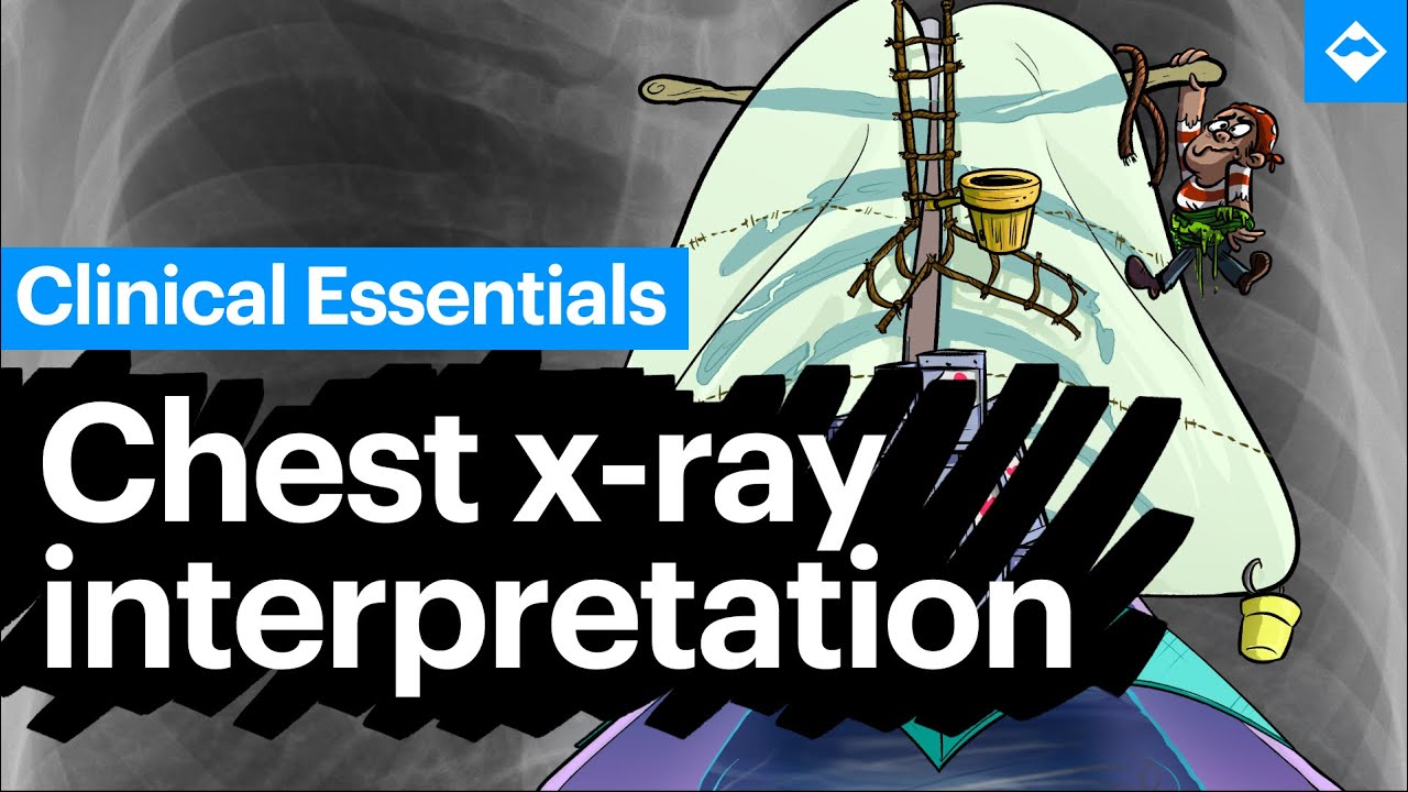 Learn Chest X-Ray (CXR) Interpretation in 8 mins with Sketchy Medical (Full Lesson)