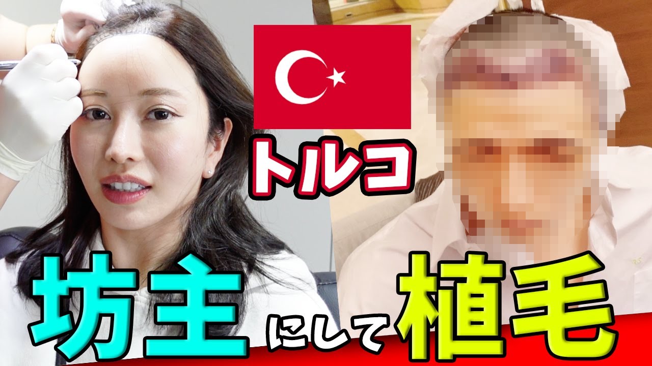 トルコで植毛しました