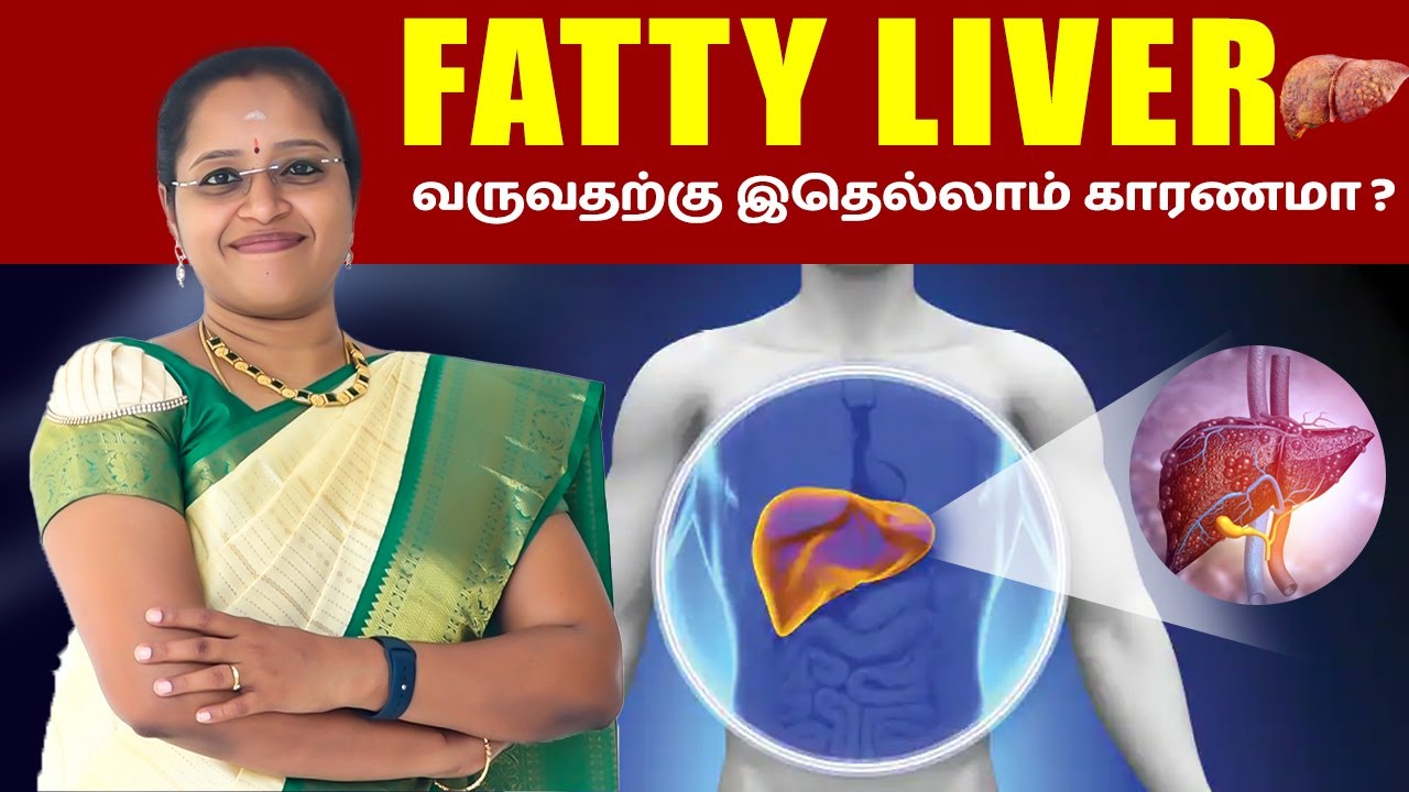 Fatty Liver வருவதற்கு இதெல்லாம் காரணமா ? | fatty liver treatment & symptoms in Tamil | Dr. A.Veni