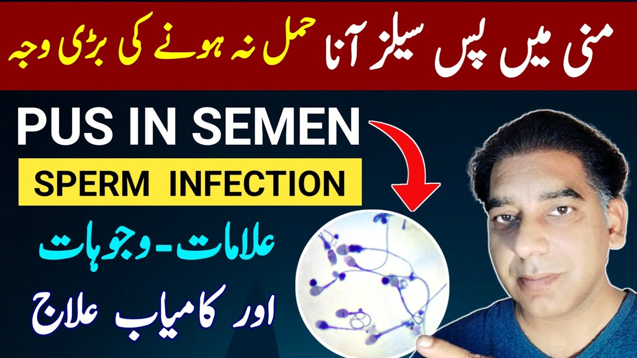 Pus Cells in Semen (Doctor Explains) | Pyospermia Causes & Treatment | Male Infertility