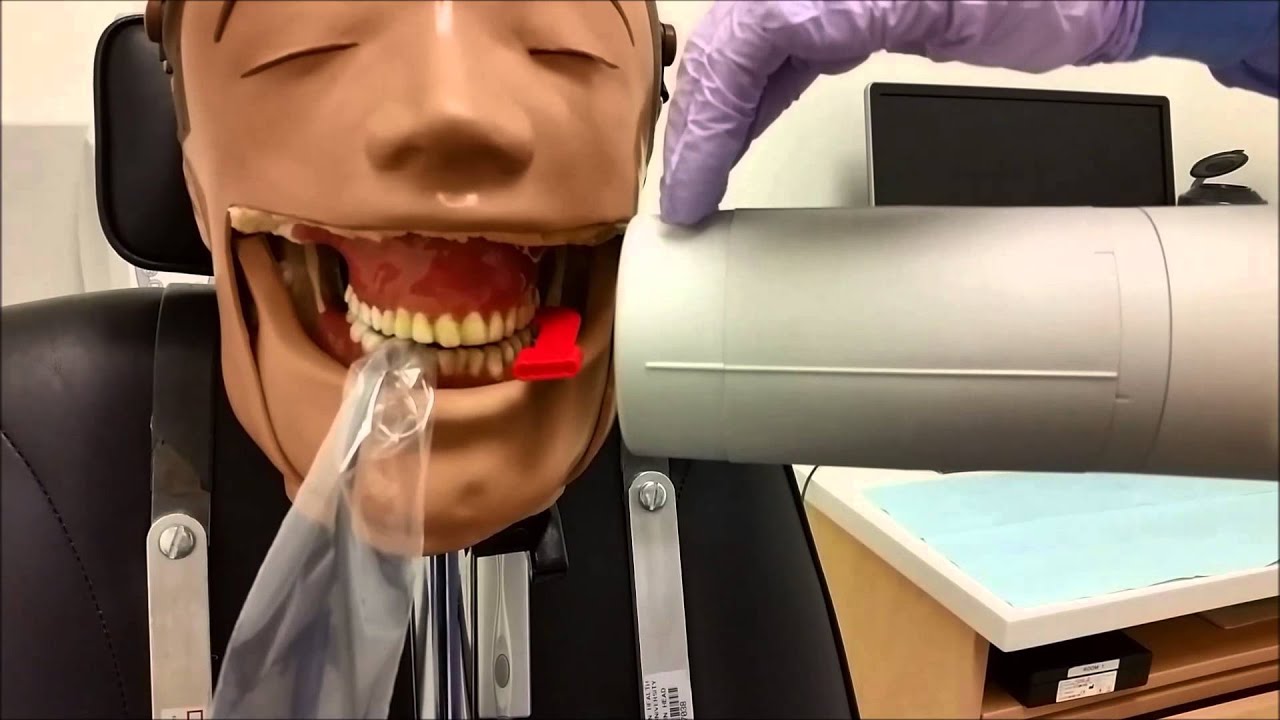 Bitewing Technique
