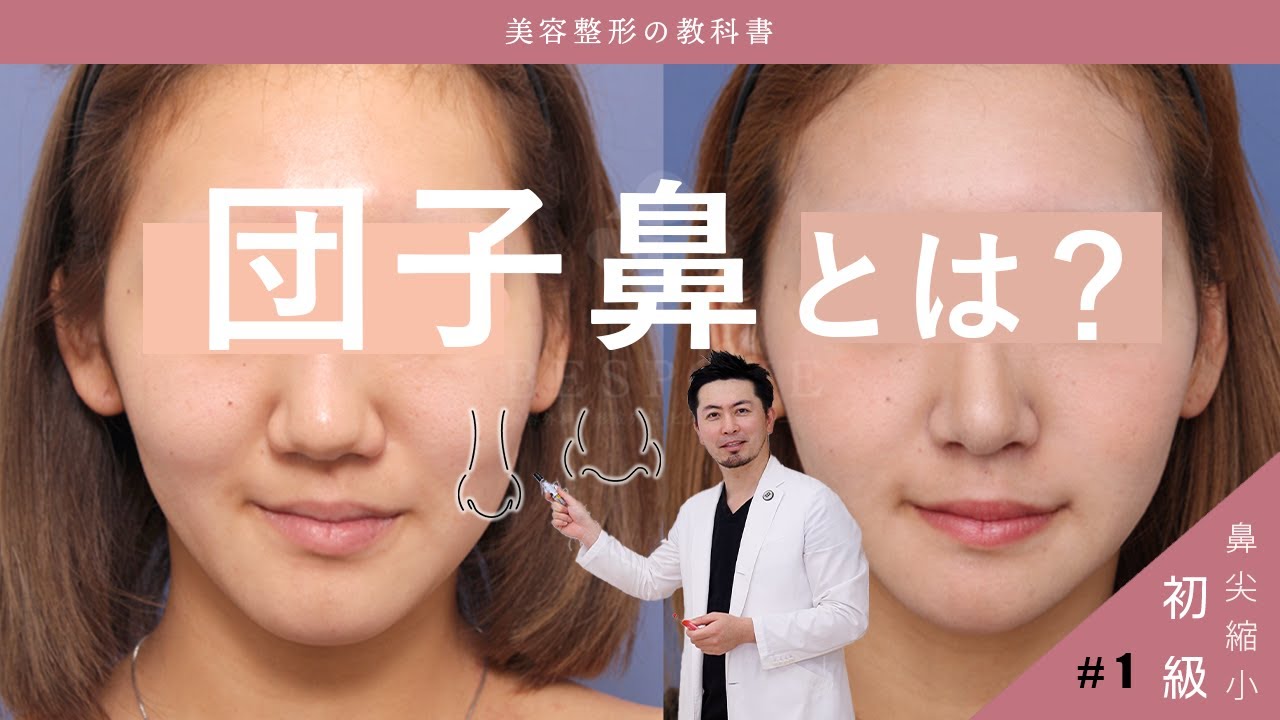 vol.1 団子鼻を治す方法【初級編】だんご鼻の種類/症例紹介/鼻尖縮小術/Q&Aなど、ビスポーククリニックの室医師が詳しく解説いたします！