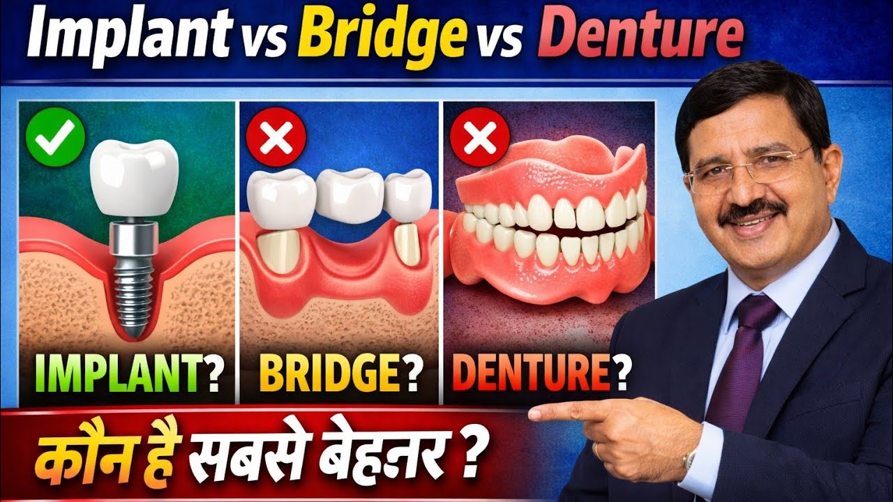 Implant vs Bridge vs Denture बेहतर?“Missing Teeth?Why  Implants“डेंचर या इम्प्लांट?”सही फैसला क्या ?