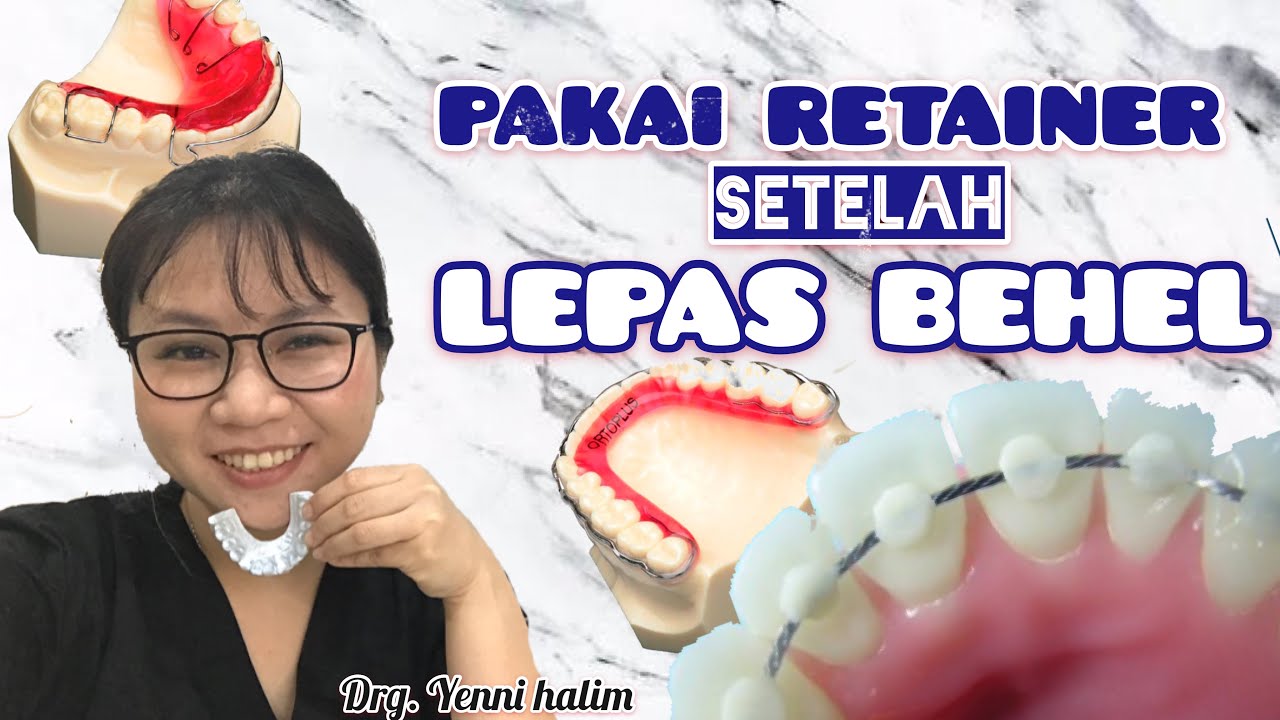 PAKAI RETAINER SETELAH LEPAS BEHEL / KAWAT GIGI