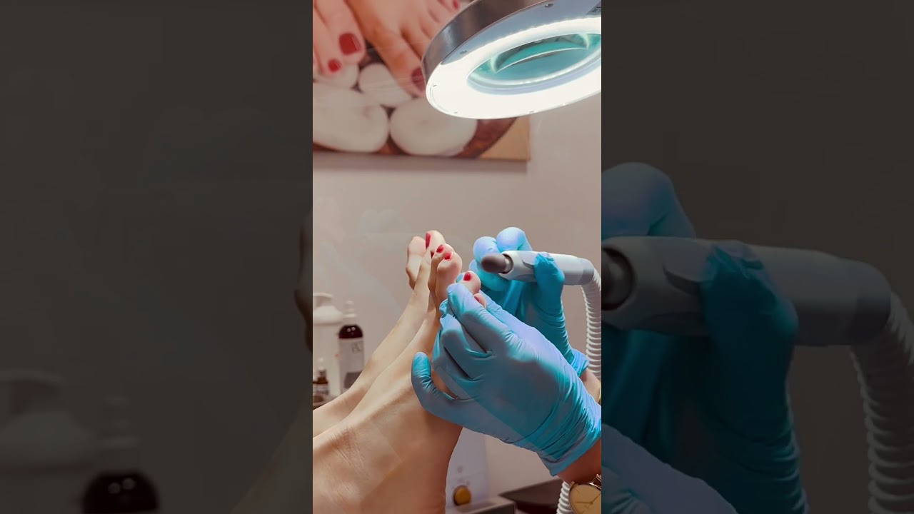 Podologia,zadbane i zdrowe stopy w PRO LASER CLINIC