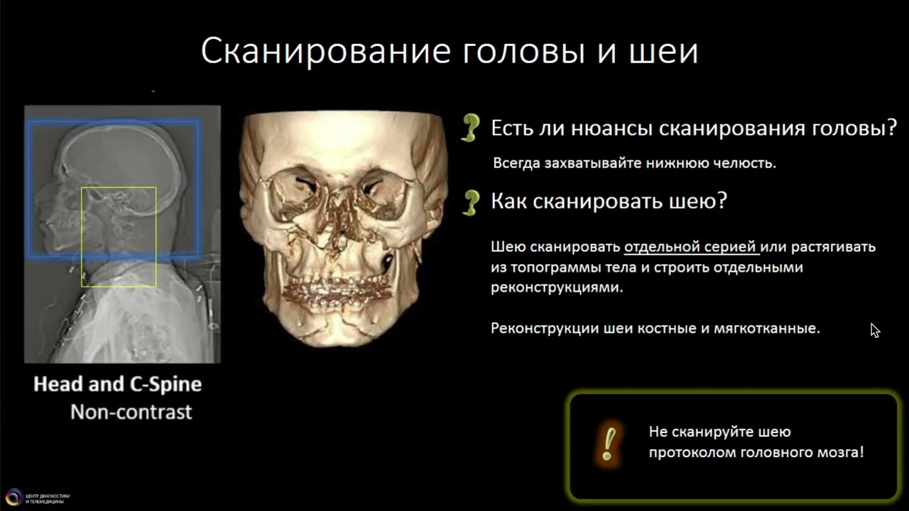 Пан КТ при политравме