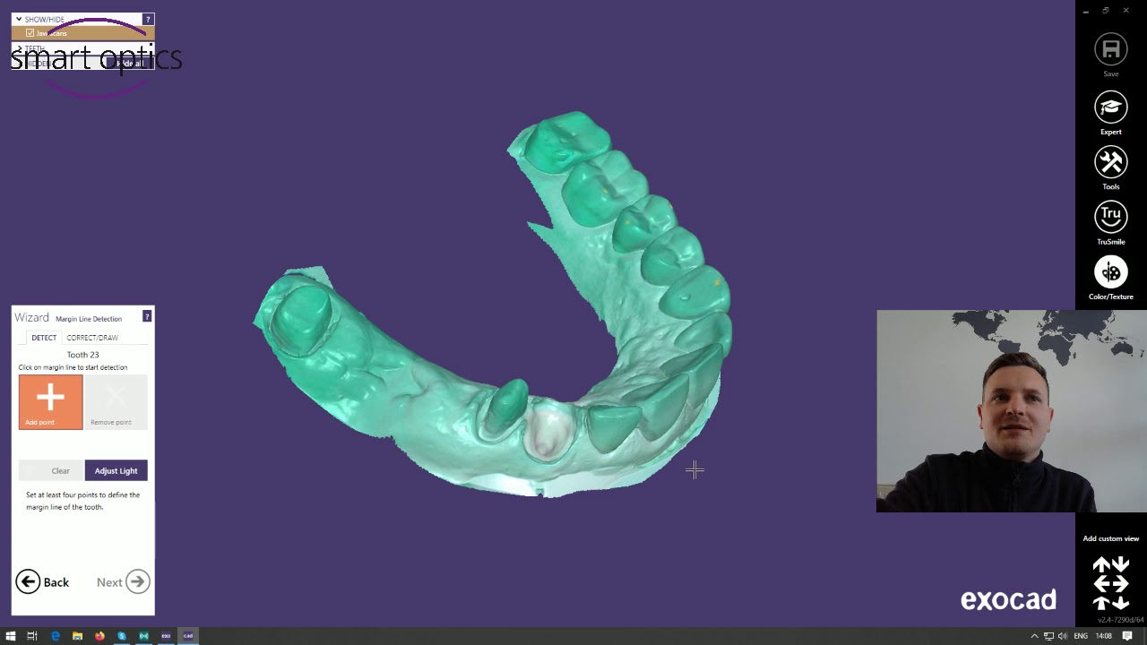 Impression scan and the design of 