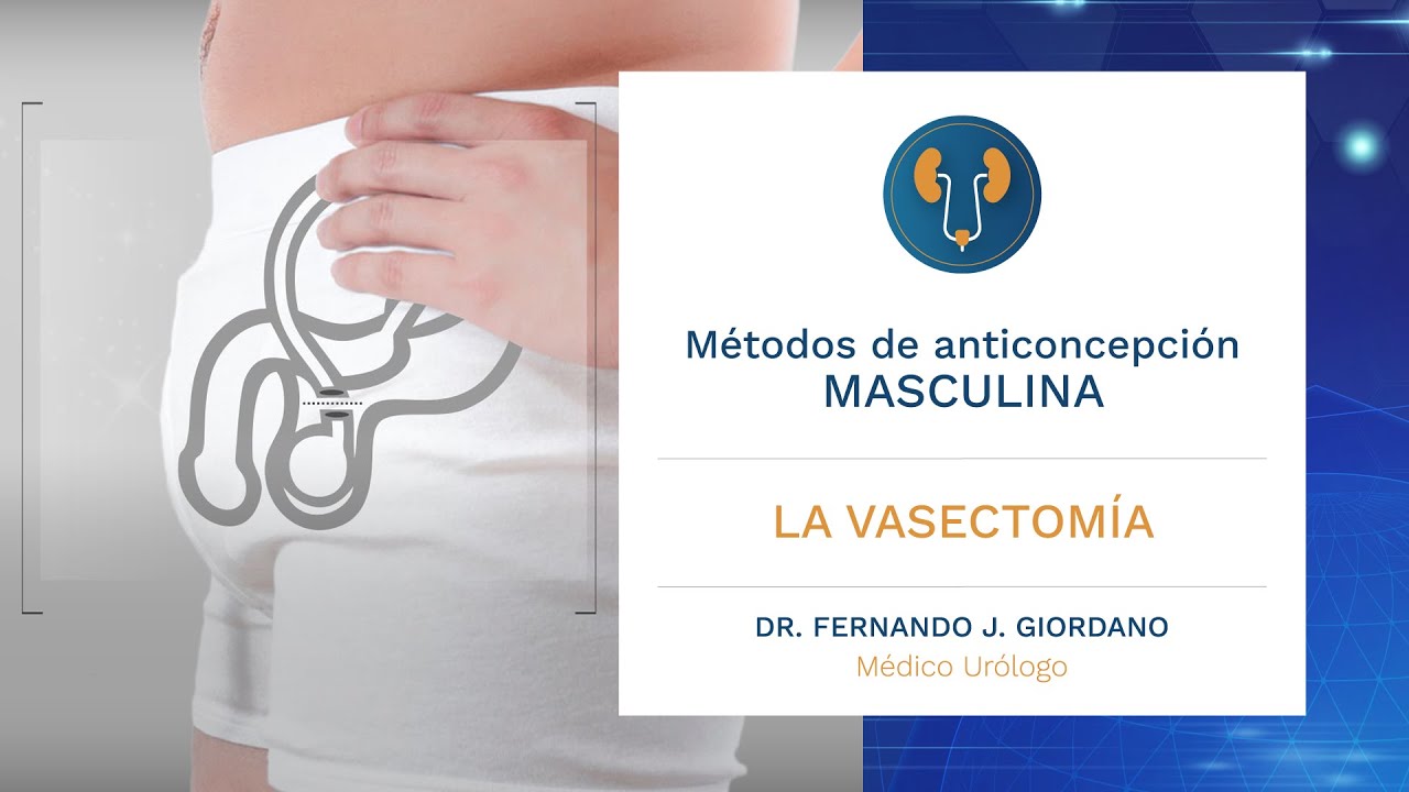 ¡LA VERDAD SOBRE LA VASECTOMÍA! ¿Es el mejor método anticonceptivo masculino? Dr. Fernando Giordano.