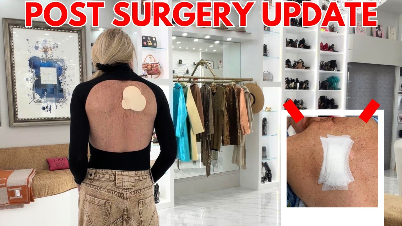 POST SURGERY UPDATE