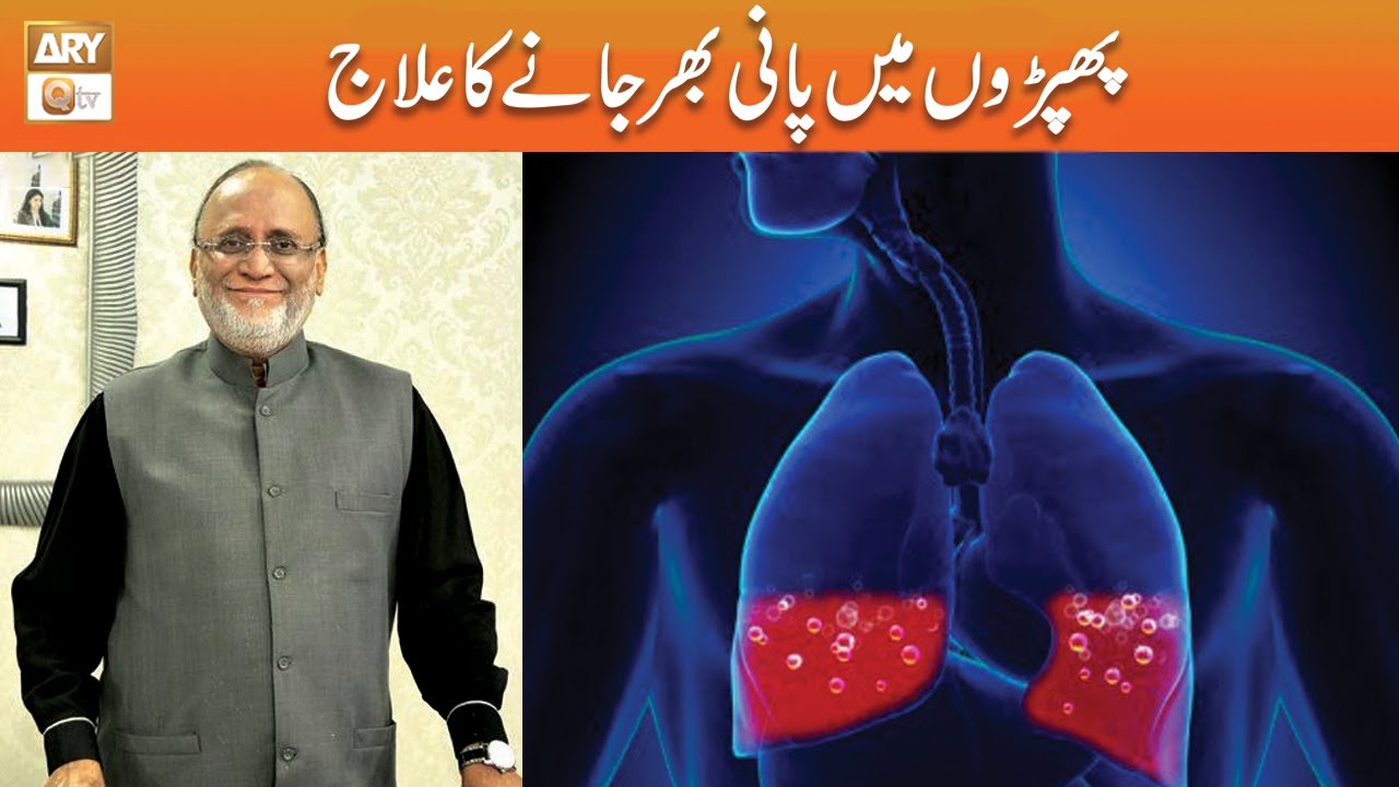 Phepron Main Pani Bhar Jane ka Ilaj | Hakeem Sayed Abdul Basit
