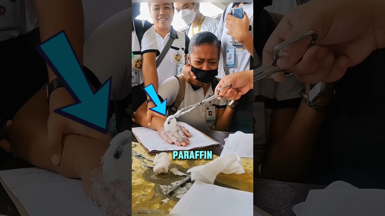 Wax Test Police Used to Catch Criminals
