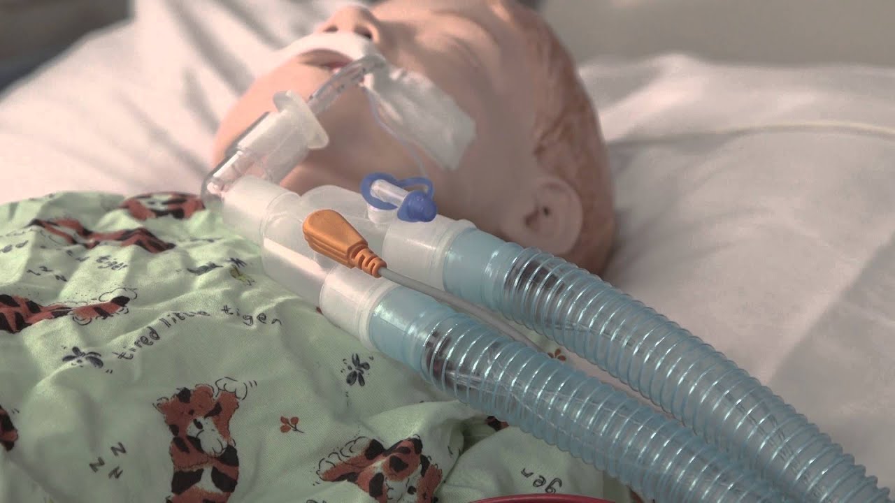 Ventilator Safety Assessment by K. Bullock | OPENPediatrics