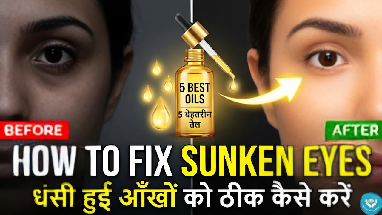 Dhasi hui aankhon ko kaise thik kare| How to Fix Sunken Eyes: 5 Best Natural Oils
