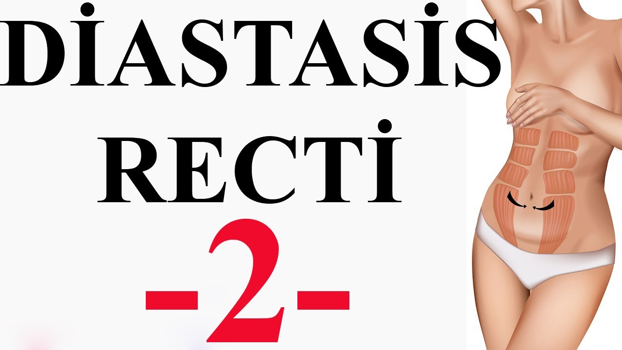 DİASTESİS RECTİ-2-