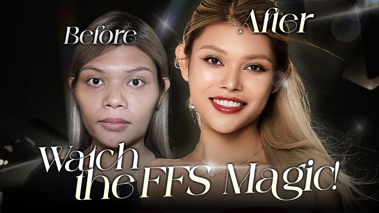 Facial Feminization Surgery changed my WHOLE life💖| @Johnreyslife's glow-up at Braun! (Part 1)