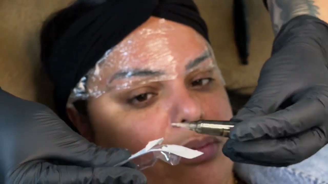 Despigmentação química Retir
