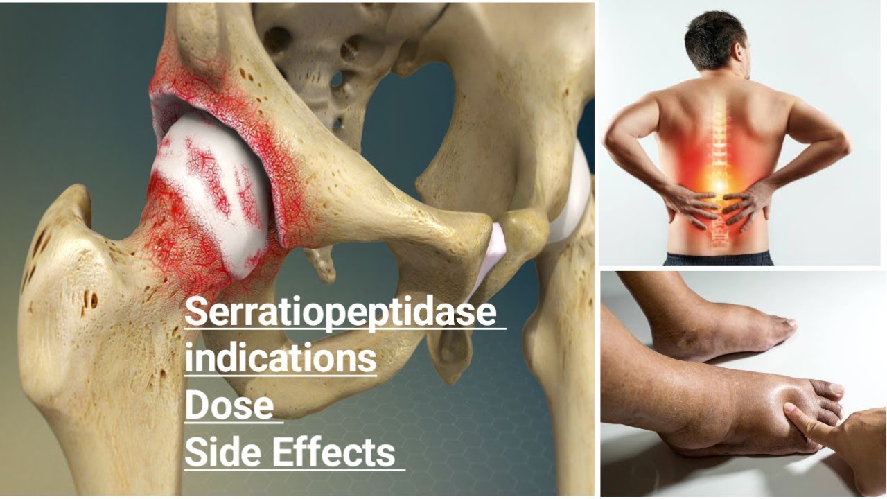 How to Use Serratiopeptidase?