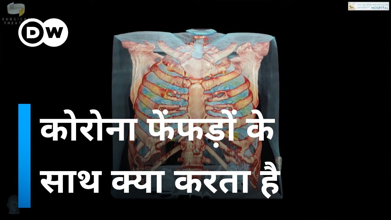 कोरोना कैसे फेफड़े पर वार करता है, देखिए [How Cororna affects our lungs]