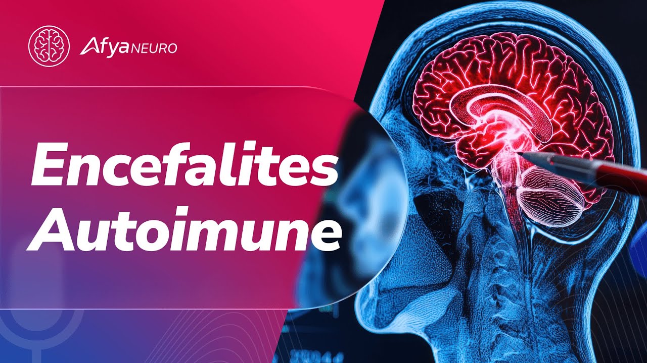 Encefalites Autoimune