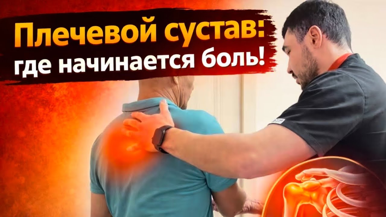 Проблемы плечевого сустава. Причины почему болит плечо и как лечить  плечо! #плечо #сустав #лечение 