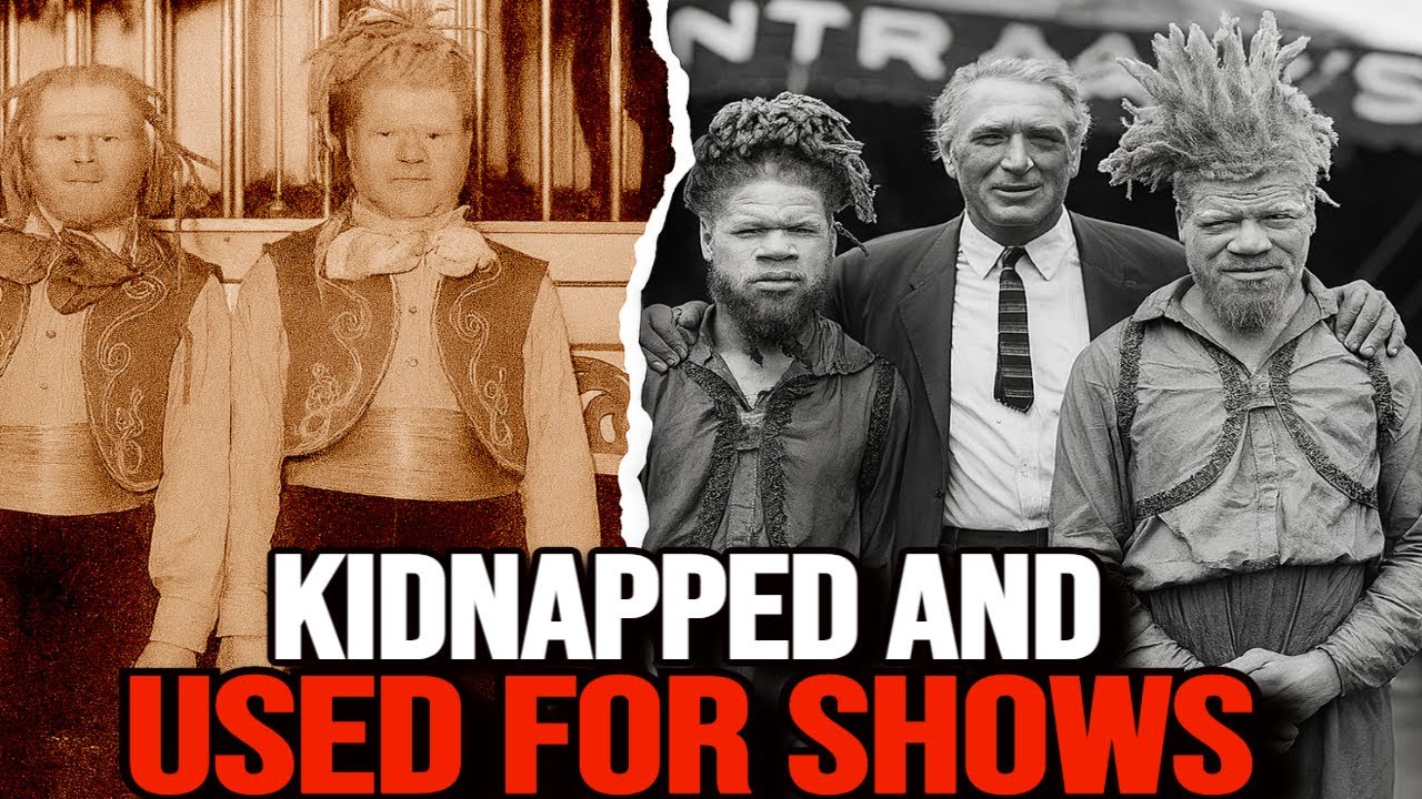 Black ALBINO Siblings Treated Like FREAKS in a Circus